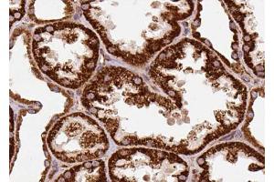 ABIN6274306 at 1/100 staining Human kidney tissue by IHC-P. (Retinol Binding Protein 5 antibody)