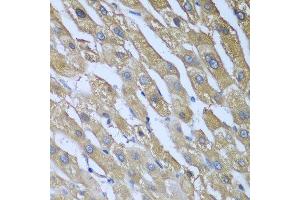 Immunohistochemistry of paraffin-embedded human liver using CAD antibody at dilution of 1:100 (40x lens).