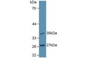 Detection of MTUS1 in Rat Brain Tissue using Polyclonal Antibody to Mitochondrial Tumor Suppressor 1 (MTUS1) (MTUS1 antibody  (AA 1018-1270))