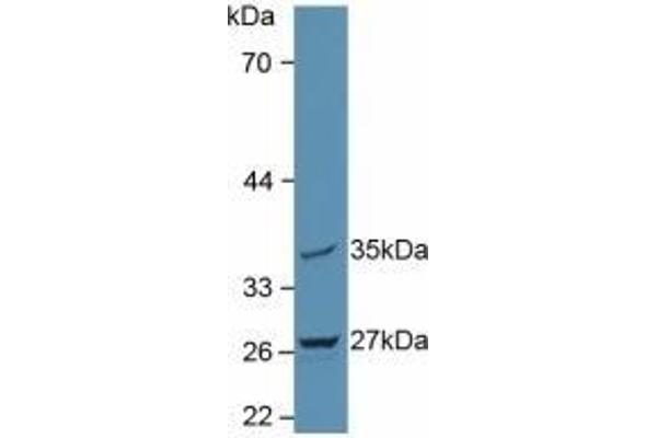 MTUS1 antibody  (AA 1018-1270)