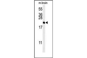 Western blot analysis of NP1L5 Antibody (Center) in Mouse brain tissue lysates (35ug/lane). (NAP1L5 antibody  (Middle Region))