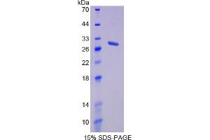 Image no. 1 for Taxilin alpha (TXLNA) (AA 328-531) protein (His tag) (ABIN4988621)