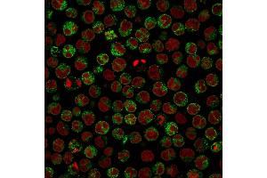 Immunofluorescence Analysis of Raji cells. (CD79a antibody)