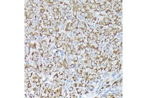 Immunohistochemistry of paraffin-embedded rat ovary using RPS15A Rabbit pAb (ABIN6131092, ABIN6147201, ABIN6147202 and ABIN6214414) at dilution of 1:200 (40x lens). (RPS15A antibody  (AA 1-130))