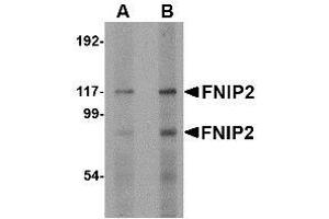 Western blot analysis of FNIP2 in rat skeletal muscle lysate with AP30345PU-N FNIP2 antibody at (A) 1 and (B) 2 μg/ml.