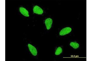 Immunofluorescence of monoclonal antibody to HIST2H2AA3 on HeLa cell. (HIST2H2AA3 antibody  (AA 1-130))