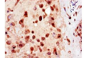 Immunohistochemistry of paraffin-embedded human placenta tissue using ABIN7174296 at dilution of 1:100