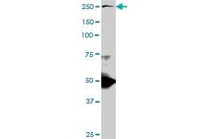 TLN1 monoclonal antibody (M06), clone 2E10. (TLN1 antibody  (AA 1052-1149))