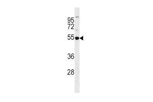 GSS Antibody (C-term) (ABIN390882 and ABIN2841094) western blot analysis in MDA-M cell line lysates (35 μg/lane). (Glutathione Synthetase antibody  (C-Term))