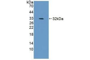 Detection of Recombinant BAFF, Mouse using Polyclonal Antibody to B-Cell Activating Factor (BAFF) (BAFF antibody  (AA 68-283))