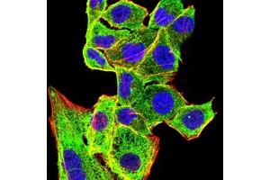 Immunofluorescence analysis of Hela cells using CD207 mouse mAb (green).