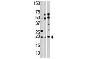Western blot analysis of RPL23A polyclonal antibody , from left to right, CEM, Hela, and HepG2 cell line lysates (35 ug/lane). (RPL23A antibody  (C-Term))