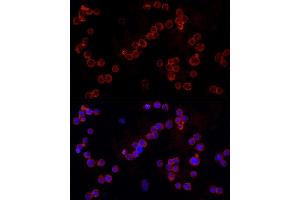 Immunofluorescence analysis of THP-1 cells using NLRC4 Rabbit pAb (ABIN6129418, ABIN6144657, ABIN6144659 and ABIN6223243) at dilution of 1:100 (40x lens). (NLRC4 antibody  (AA 1-250))