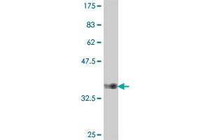 Western Blot detection against Immunogen (37 KDa) . (DPYSL3 antibody  (AA 457-555))