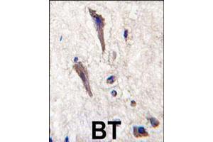 Formalin-fixed and paraffin-embedded human brain tissue reacted with SPRED1 polyclonal antibody  , which was peroxidase-conjugated to the secondary antibody, followed by DAB staining. (SPRED1 antibody  (N-Term))