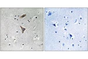 Immunohistochemistry analysis of paraffin-embedded human brain tissue, using KCNT1 Antibody. (KCNT1 antibody  (AA 1019-1068))