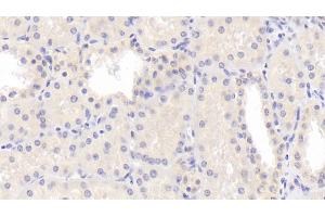 Detection of LPCAT1 in Human Kidney Tissue using Polyclonal Antibody to Lysophosphatidylcholine Acyltransferase 1 (LPCAT1) (LPCAT1 antibody  (AA 70-237))