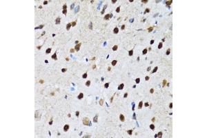 Immunohistochemistry of paraffin-embedded rat brain using CC antibody (ABIN6133528, ABIN6138034, ABIN6138035 and ABIN6222941) at dilution of 1:100 (40x lens).