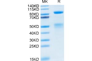 SDS-PAGE (SDS) image for Met Proto-Oncogene (MET) (AA 25-932) protein (His-Avi Tag) (ABIN7275248)
