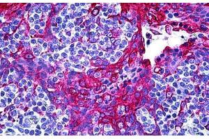 Human Tonsil, Squamous Epithelium: Formalin-Fixed, Paraffin-Embedded (FFPE) (AKR1C4 antibody  (AA 1-324))