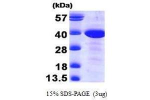 Figure annotation denotes ug of protein loaded and % gel used. (MAT2B Protein (AA 1-323))