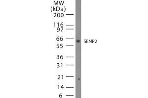 Image no. 1 for anti-SUMO1/sentrin/SMT3 Specific Peptidase 2 (SENP2) (AA 500-550) antibody (ABIN208758) (SENP2 antibody  (AA 500-550))