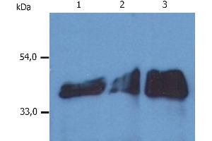 Western Blotting analysis (reducing conditions) of whole cell lysate using anti-human Cytokeratin 18 (DA-7). (Cytokeratin 18 antibody  (Biotin))