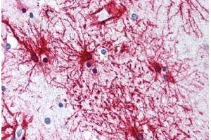 Human Brain, Cortex, Astrocytes (formalin-fixed, paraffin-embedded) stained with GFAP antibody ABIN305893 at 5 ug/ml followed by biotinylated anti-goat IgG secondary antibody ABIN481715, alkaline phosphatase-streptavidin and chromogen. (GFAP antibody  (AA 417-430))