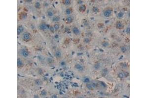IHC-P analysis of Human Tissue, with DAB staining. (TRX2 antibody  (AA 60-166))