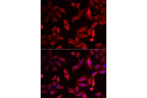 Immunofluorescence analysis of HeLa cells using SERPINB9 antibody (ABIN5973795). (SERPINB9 antibody)
