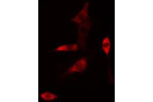 ABIN6268761 staining HUVEC cells by IF/ICC. (Claudin 6 antibody  (Internal Region))