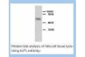 Image no. 2 for anti-Alkaline Phosphatase, Liver/bone/kidney (ALPL) (N-Term) antibody (ABIN1495053) (ALPL antibody  (N-Term))