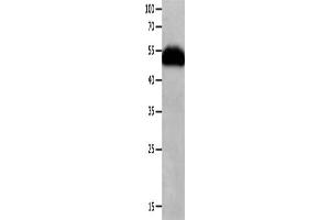 Gel: 10 % SDS-PAGE, Lysate: 40 μg, Lane: Human fetal lung tissue, Primary antibody: ABIN7190258(CHRNA3 Antibody) at dilution 1/600, Secondary antibody: Goat anti rabbit IgG at 1/8000 dilution, Exposure time: 1 minute (CHRNA3 antibody)