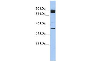 WB Suggested Anti-MGC48628 Antibody Titration: 0. (MGC48628 (N-Term) antibody)