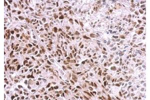 IHC-P Image SAMHD1 antibody [N2C2], Internal detects SAMHD1 protein at nucleus on SkHep1 xenograft by immunohistochemical analysis. (SAMHD1 antibody  (Internal Region))
