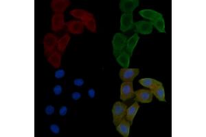 ABIN6262807 and ABIN6278585 staining Hela cells(24h of starvation treatment) by IF/ICC. (KIF20A antibody  (C-Term))