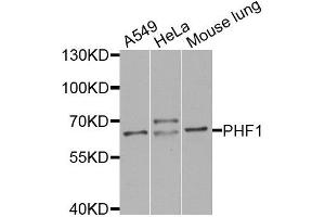 Western blot analysis of extracts of various cell lines, using PHF1 antibody (ABIN5974685) at 1/1000 dilution. (PHF1 antibody)
