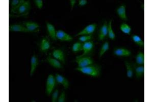 Immunofluorescence staining of Hela cells with ABIN7159545 at 1:133, counter-stained with DAPI. (MT3 antibody  (AA 1-68))