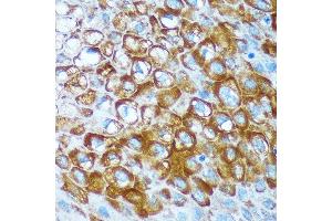 Immunohistochemistry of paraffin-embedded Human esophageal using RCE1 Rabbit pAb (ABIN7265987) at dilution of 1:100 (40x lens).