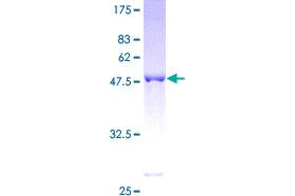 UCHL3 Protein (AA 1-230) (GST tag)