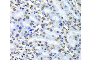 Immunohistochemistry (Paraffin-embedded Sections) (IHC (p)) image for anti-Septin 7 (SEPT7) antibody (ABIN7260851)