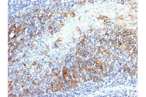 Formalin-fixed, paraffin-embedded human Tonsil stained with CDC20 Mouse Monoclonal Antibody (AR12). (CDC20 antibody)