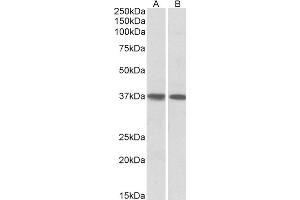 ABIN5539769 (1µg/ml) staining of Human Heart (A) and Lung (B) lysates (35µg protein in RIPA buffer). (KLF2 antibody  (N-Term))