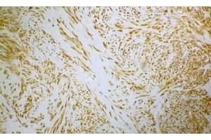 Image no. 1 for anti-Desmin (DES) antibody (ABIN335365) (Desmin antibody)
