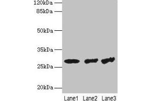 Western blot All lanes: TBCB antibody at 4 μg/mL Lane 1: Hela whole cell lysate Lane 2: A549 whole cell lysate Lane 3: Jurkat whole cell lysate Secondary Goat polyclonal to rabbit IgG at 1/10000 dilution Predicted band size: 28, 22 kDa Observed band size: 28 kDa (TBCB antibody  (AA 1-244))