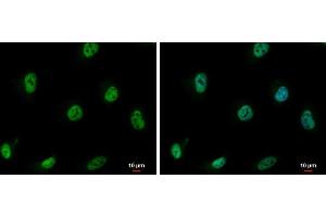 Immunofluorescence (IF) image for anti-CSE1 Chromosome Segregation 1-Like (CSE1L) (Center) antibody (ABIN2855534)