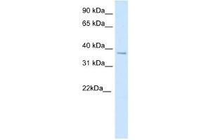 SFPI1 antibody (20R-1184) used at 0. (SPI1 antibody  (N-Term))