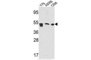 Western blot analysis of SAP Antibody (Center E300) in Y79,A2058,CEM cell line lysates(35ug/lane).