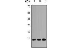 Western blot analysis of Profilin 1 expression in HT29 (A), PC12 (B), COS7 (C) whole cell lysates. (PFN1 antibody)