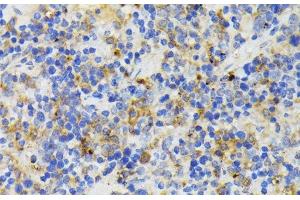 Immunohistochemistry of paraffin-embedded Mouse spleen using TREM2 Polyclonal Antibody at dilution of 1:200 (40x lens). (TREM2 antibody)